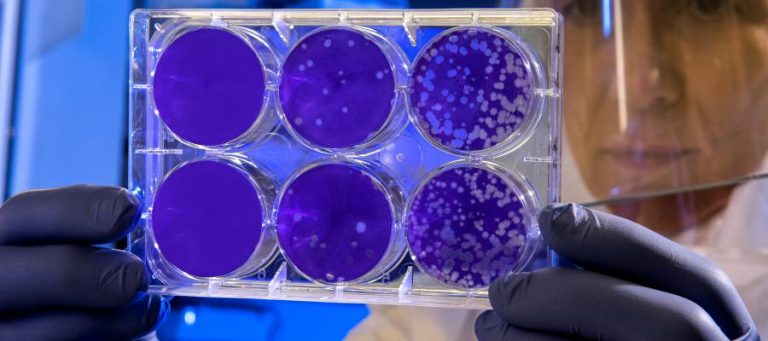 Scientist examining petri dishes with bacterial cultures in a lab.